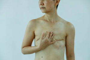 surgery gone wrong